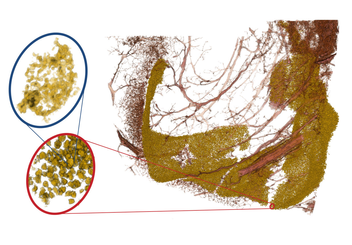 Das Bild zeigt neuronale Zellkerne der sogenannten Dentus gyratus (gelb) und dazu gehörige Blutgefäße (rot). Durch unterschiedliche Vergrößerung der Röntgenoptik kann man in das dicht gepackte Band von Neuronen 