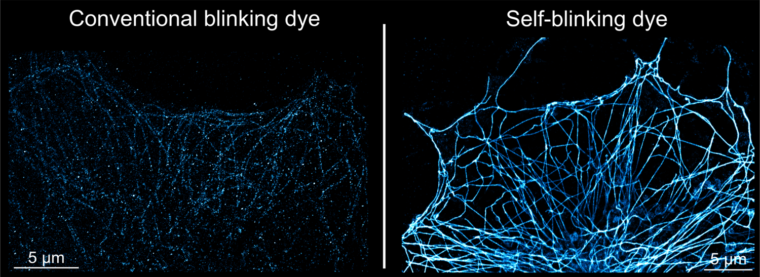 The image on the left shows super-resolution imaging using nanobodies with conventional blinking dye (where the blinking is poor), the image on the right shows self-blinking dye resulting in en-hanced image quality. Both images show microtubules, part of the internal structural network that helps cells maintain their shape and organize transport, in human U2OS cells, a widely used laboratory cell line.