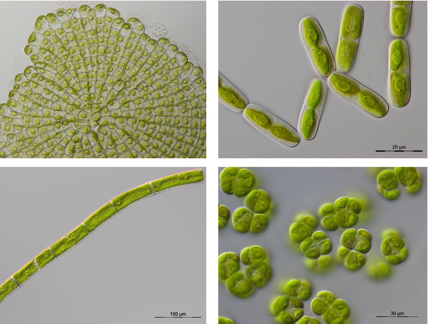 Producing high quality reference genomes for plants, like this humble streptophyte alga, can provide important clues for understanding the evolution of plants on land as well as different methods of photosynthesis and so inform conservation measures