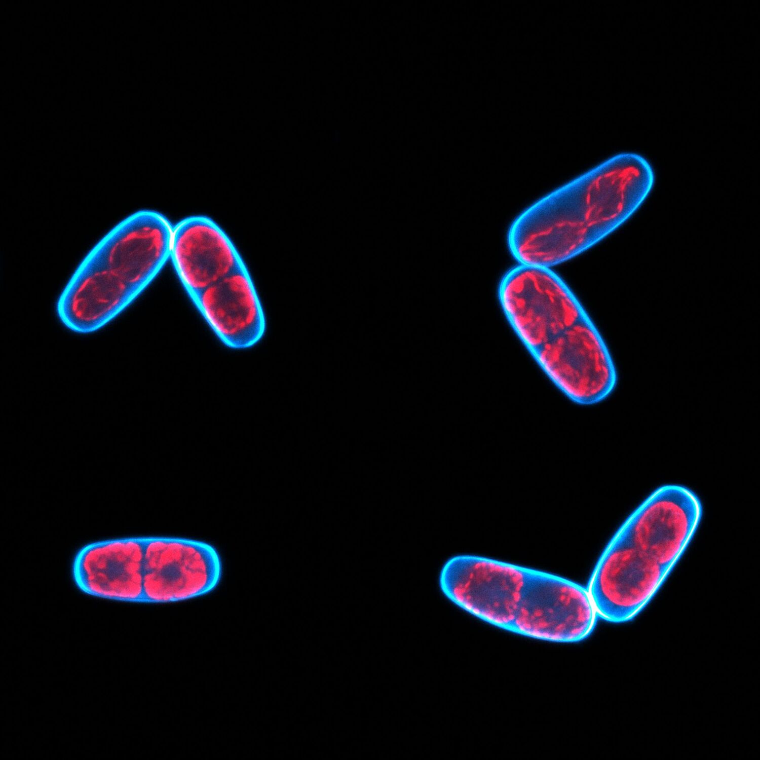 The confocal microscope image shows the huddled appearance of the Mesotaenium cells upon UV exposure; the plastid autofluoresces red, the cell wall was stained with a cyan dye.