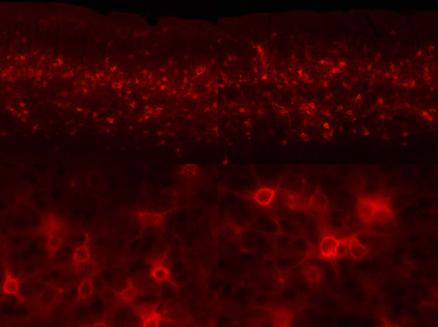 Neuronale Plastizität wird durch den enzymatischen Abbau der extrazellulären Matrix des Gehirns gefördert. Diese fluoreszenzmikroskopische Aufnahme zeigt Nervenzellen aus der Sehrinde einer Maus, die von rot markierten ECM Molekülen umhüllt sind.  Obere Reihe: niedrige Vergrößerung, untere Reihe: höhere Vergrößerung.