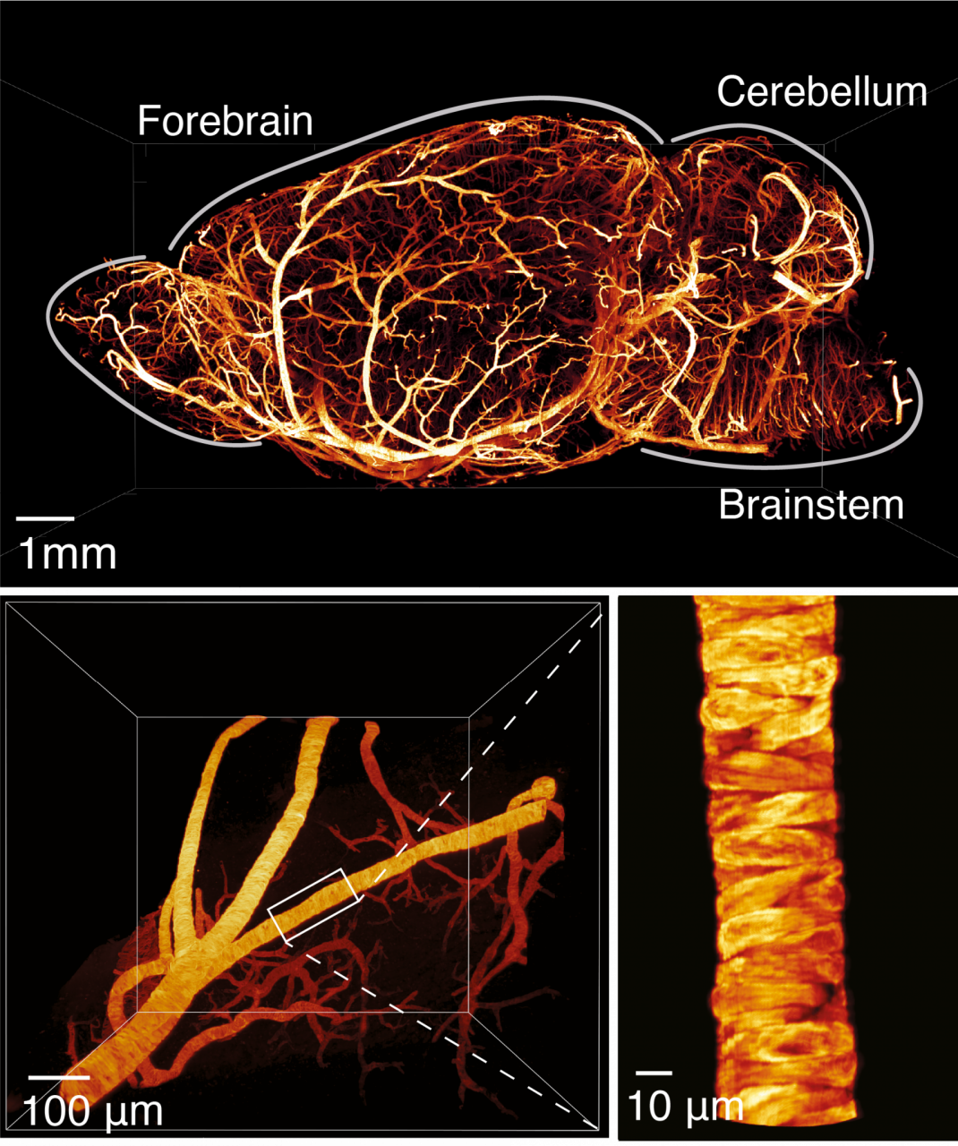 Side view of a mouse brain (left) and detailed images of a blood vessel (right) made using the technologically innovative platform designed for light sheet fluorescence microscopy developed by researchers. This imaging technique uses special (fluorescent) molecules to make structures glow.