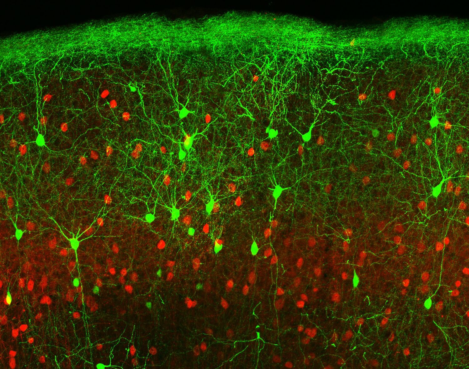 Die beiden untersuchten Zelltypen hier farbstoffmarkiert im Kortex einer Maus (rot: schnell feuernde, grün: adaptierende Interneuronen).