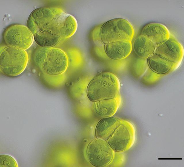Mikroskopisches Bild der mehrzelligen Alge Streptosarcina arenaria (Maßstab: 10 µm = 0,01 mm). Die landlebende Art kommt in trockenen und tropischen Regionen vor.