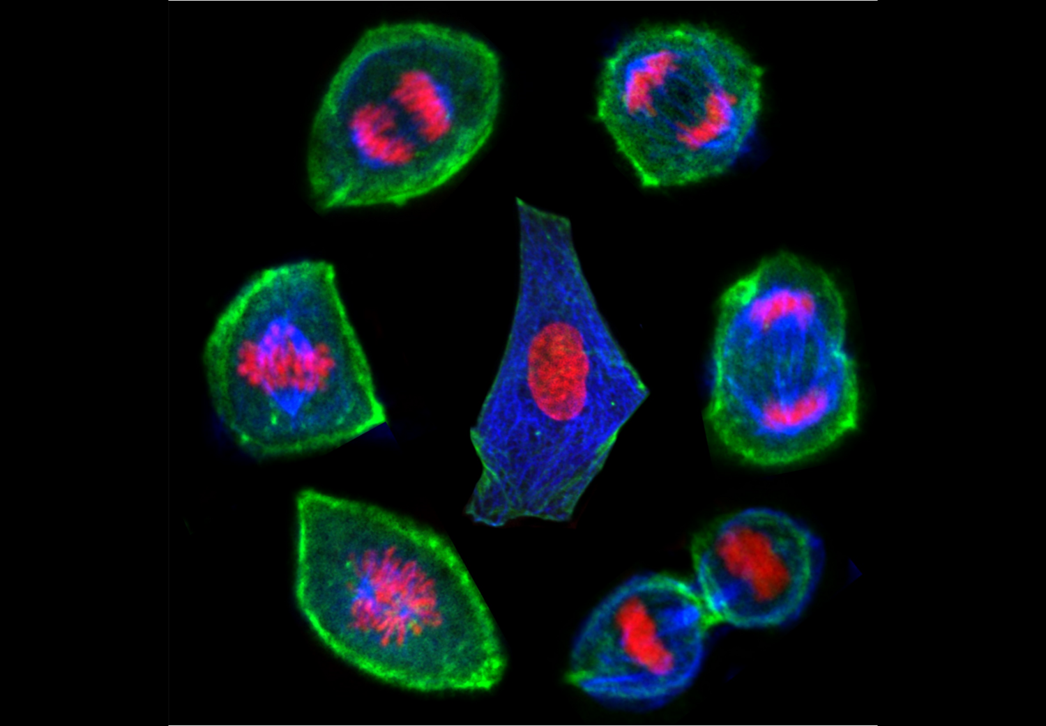 Lifecycle of a biological cell: cell (in centre) before mitosis (cell division) takes place. From bottom left and then clockwise: the cells become rounder and the shell thickens as the insides of the cell change - soften and fluidify. The genetic material is shared out to create two new daughter cells. (Image taken with a confocal microscope, research carried out using optical tweezers)