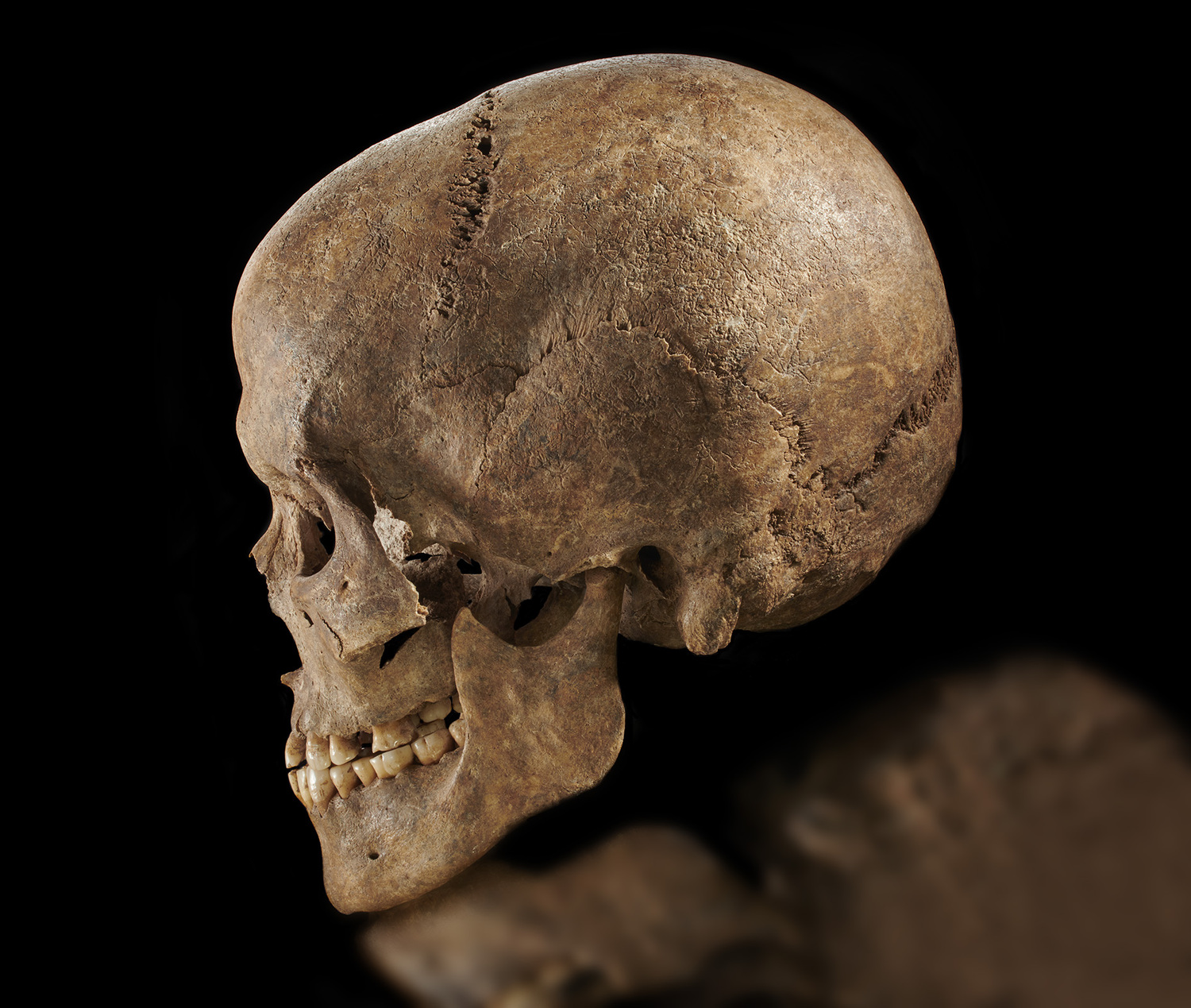 Skull of a young man from the Middle Stone Age cemetery of Groß Fredenwalde (Brandenburg), buried around 5000 BC. The man - typical of the late hunter-gatherer-fishers - lived at a time when the first farmers had already established their settlements and fields in the region.