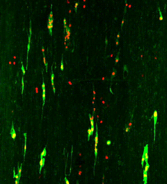 One of the aims of Timo Betz’ research is to understand cancer cell migration by using structured, synthetic 3D environments that resemble the tissue found in the body. This image shows fibroblasts which were cultured with cancer cells to study the invasion of these cells in such a biopolymer based tissue. The cancer cells’ nuclei are marked red, with some actin filaments marked green. Cells start to divide uncontrollably after several days as is seen in cancer metastasis.