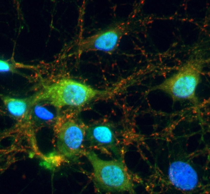 Synapses in neuronal cell cultures, stained using new methods developed in the CRC 1286.