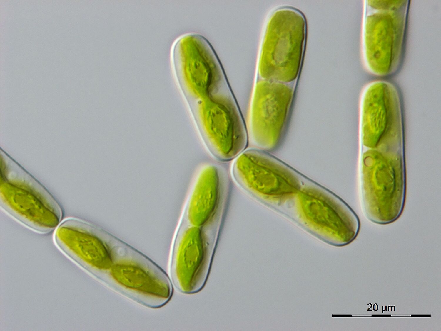 Mikroskopische Aufnahme einer der engsten Verwandten der Landpflanzen, einer einzelligen Alge namens Mesotaenium endlicherianum (20 Mikrometer entsprechen 0,02 Millimetern).