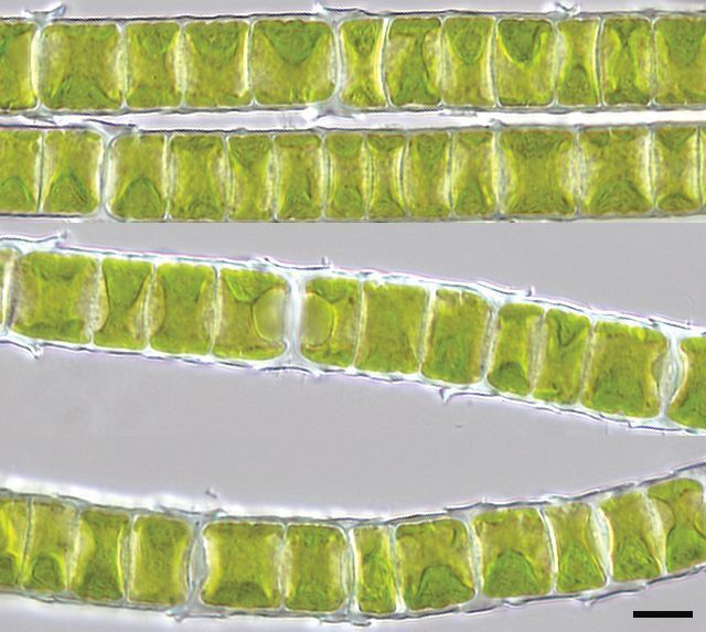 Mikroskopisches Bild der mehrzelligen, fadenförmigen Alge Klebsormidium crenulatum (Maßstab: 10 µm = 0,01 mm). Mit einer dicken Zellwand ist die landlebende Art sehr resistent gegen Austrocknung.