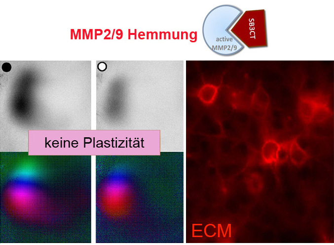 Neuronale Plastizität wird durch den enzymatischen Abbau der extrazellulären Matrix (ECM) gefördert.