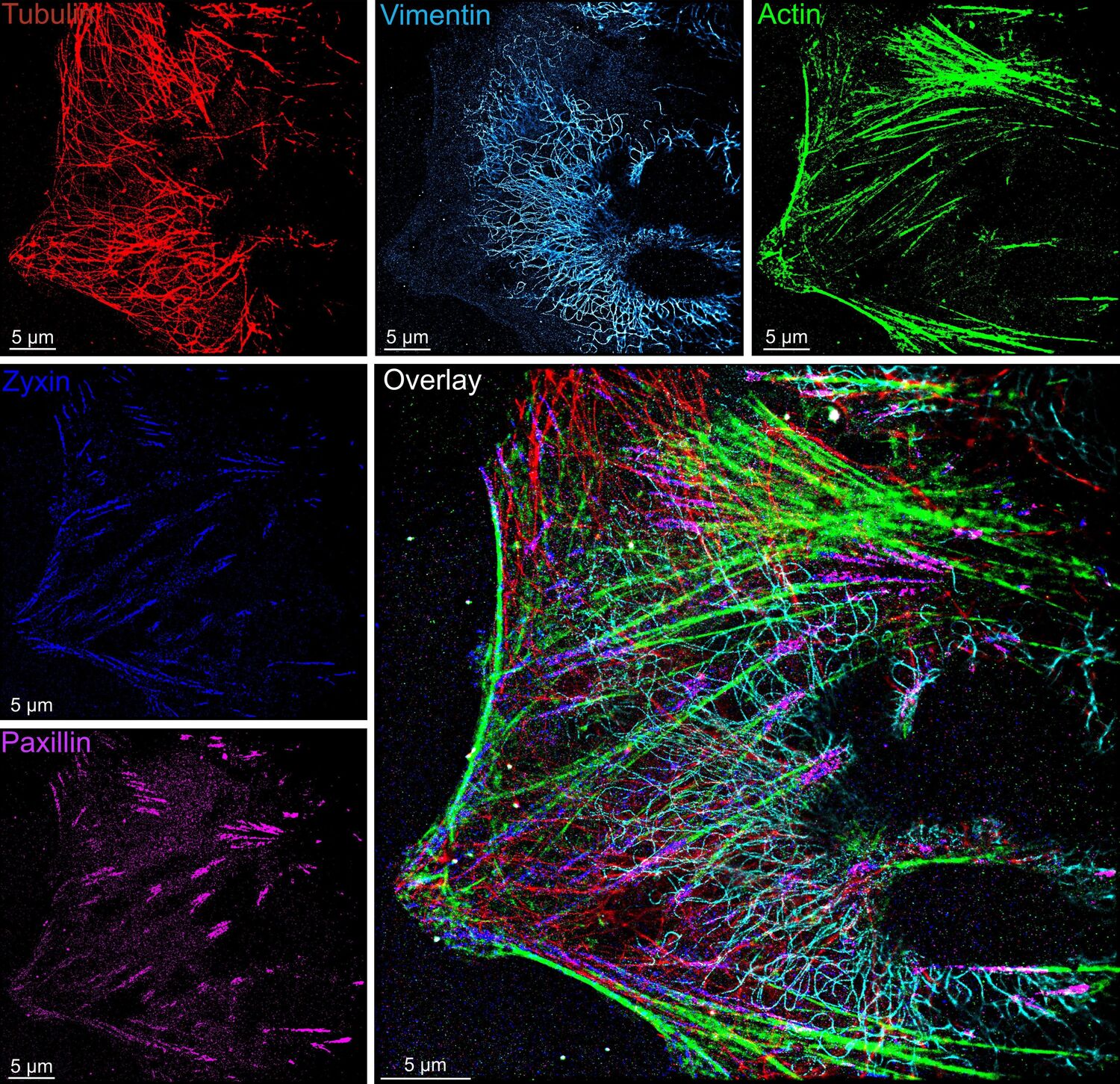 Superaufgelöstes Bild des Zellskeletts und der Proteine (kleine Bilder), die dieses an die extrazelluläre Matrix koppeln (fokale Adhäsion), aufgenommen mit dem Mikrofluidik-System. Durch die überlagerte Darstellung aller Proteine (großes Bild: Overlay) erscheinen komplexe Details bis zu 100-mal schärfer als bei herkömmlicher Lichtmikroskopie.
