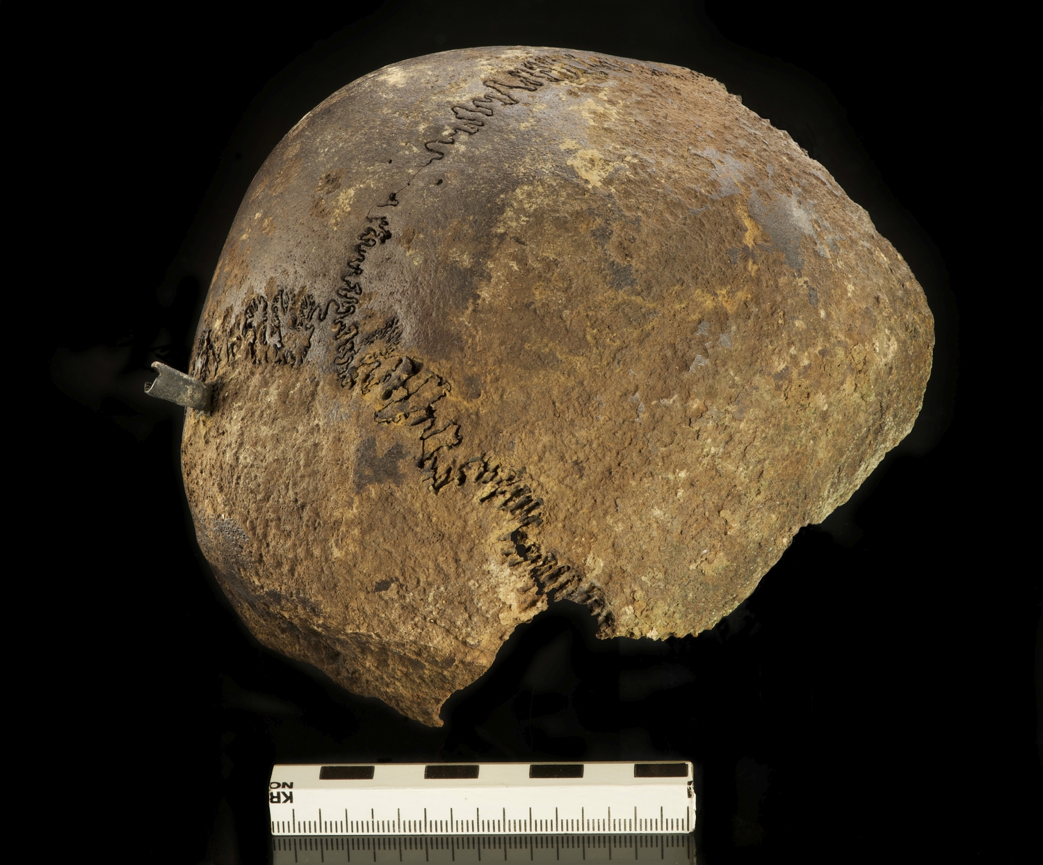 Human skull found in the Tollense valley with fatal trauma caused by a Bronze arrowhead.