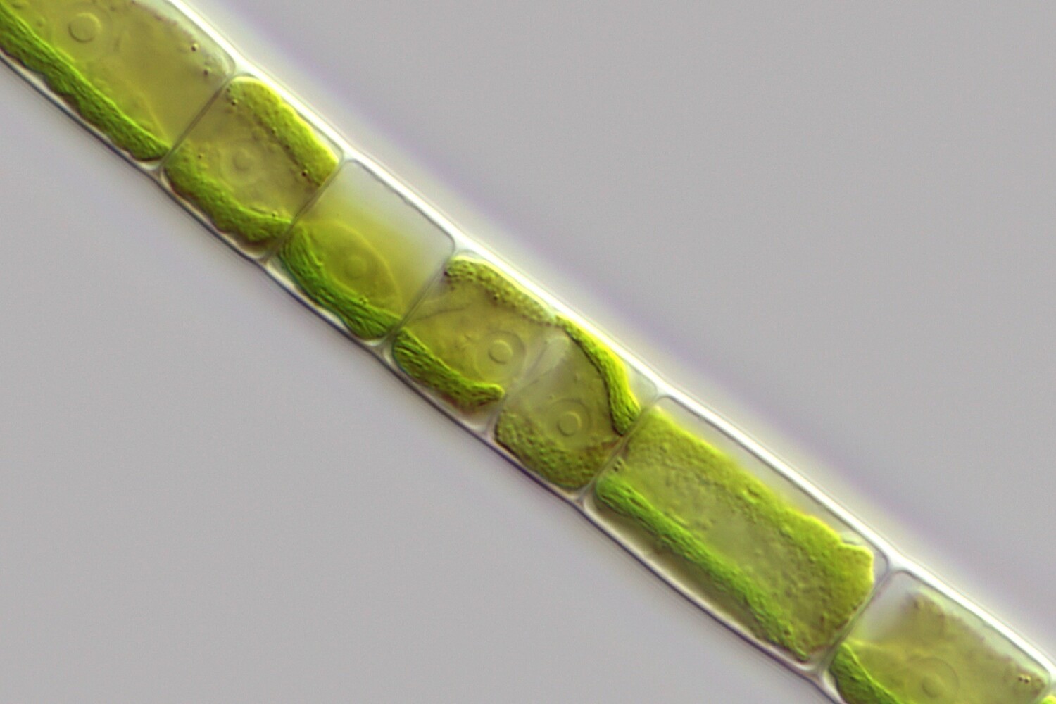 The team of researchers used hundreds of gene sequences to collect tens of thousands of the molecular characters that make up algal DNA. This enabled them to robustly reconstruct the relationship and evolutionary history of the Zygnematophyceae.