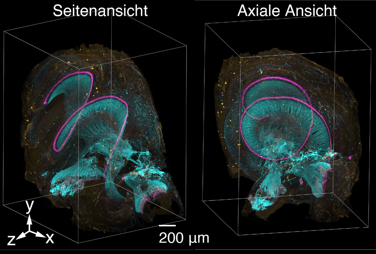Hörschnecke eines menschlichen Innenohrs sichtbar gemacht mit dem neuartigen Lichtblatt-Fluoreszenzmikroskop