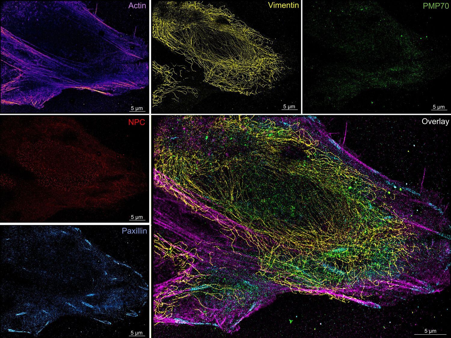Multiplexed super-resolution image of targets inside the same U2OS cell taken using the newly developed microfluidics system. Target molecules in the sample are labelled with DNA featuring different sequences but the same color. Different target proteins can be located with nanometer precision, and overlaid to create a final image.