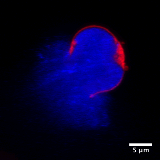 Weißes Blutkörperchen nach dem Prozess der NETose. Blau: DNA/Chromatin, Rot: Zellmembran.