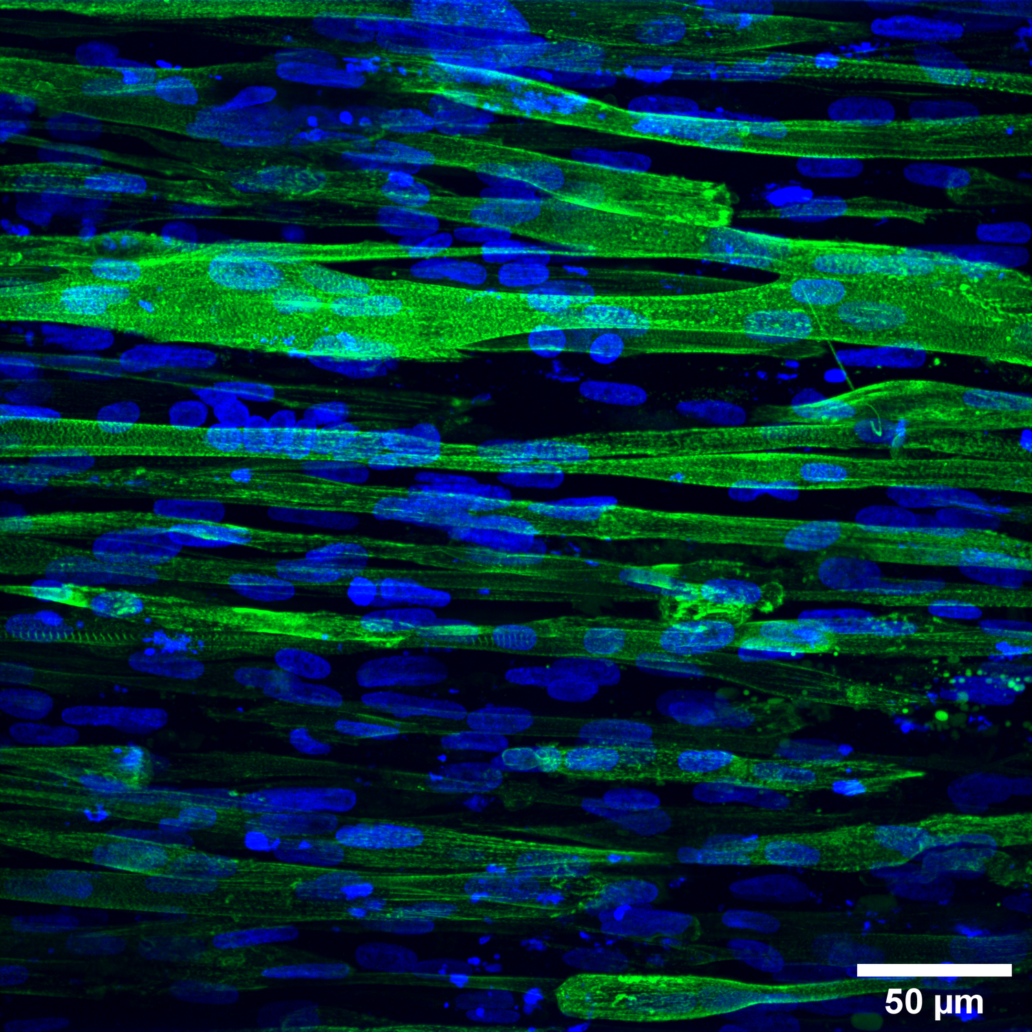 Rekonstituiertes Muskelgewebe von einem Spender mit Duchenne-Muskeldystrophie. Die Zellkerne sind blau und der kontraktile Apparat ist grün.
