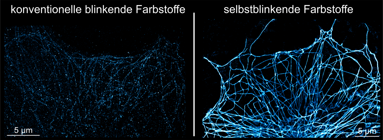 Links: Superauflösungsaufnahme mithilfe von Nanokörpern mit einem herkömmlichen blinkenden Farbstoff, bei dem das Blinken nur schwach ausgeprägt ist. Rechts: Selbstblinkender Farbstoff, der zu einer verbesserten Bildqualität führt. Beide Bilder zeigen Mikrotubuli: Teile des inneren Struktur-Netzwerks, das den Zellen hilft, ihre Form zu bewahren und den Transport zu organisieren.