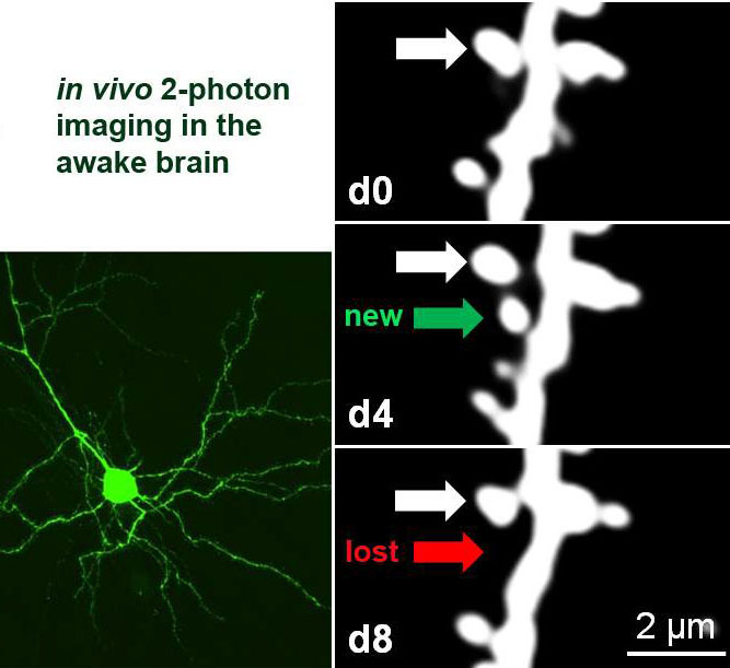 Chronisches 2-Photonen Imaging fluoreszenzmarkierter Nervenzellen in der Hirnrinde wacher Mäuse: während der ersten 4 Tage, von Tag 0 (d0) bis Tag 4 (d4), wurde eine dendritische Dorne neu gebildet (weiße Ausbuchtung, grüner Pfeil); nach spezifischer Reizung eines Auges in den nächsten 4 Tagen (bis d8), wurde die Dorne eliminiert (roter Pfeil). Der weiße Pfeil zeigt auf eine stabile Dorne. Die Eliminierung von dendritischen Dornen in diesem Paradigma sieht man normalerweise nur bei jungen Mäusen, wurde hier aber auch in Nervenzellen ohne PSD-95 bei erwachsenen Tieren beobachtet. Dies weist darauf hin, dass PSD-95 notwendig für die Reifung und Stabilisierung von Synapsen ist.