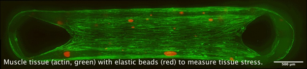 The new Volkswagen Foundation Momentum funding will allow to apply the knowledge gained from observing biological processes to create newly developed synthetic materials. The image shows muscle tissue (actin filaments marked green), which is being studied using synthetic elastic beads (red).