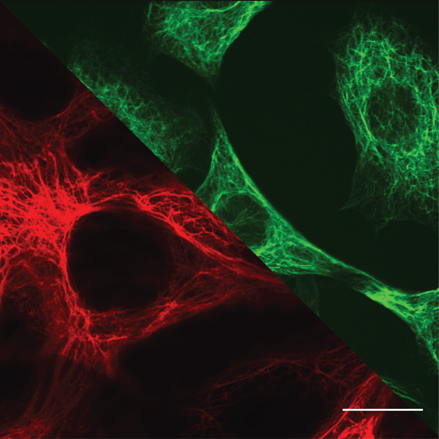 Microscopy images of biological cells: top right (green) - Vimentin intermediate filaments in fibroblasts; bottom left (red) - Keratin intermediate filaments in epithelial cells. Scale: 10 µm.